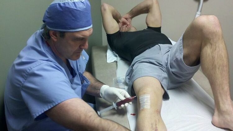 Dermankirina arthrossis of the kne