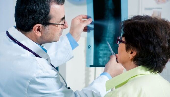 radyografî wekî rêbazek ji bo teşhîskirina osteochondrosis ya malzarokê