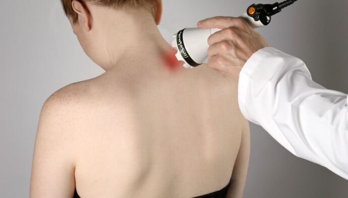 tedawiya lazerê ji bo osteochondrosis malzaroka malzarokê